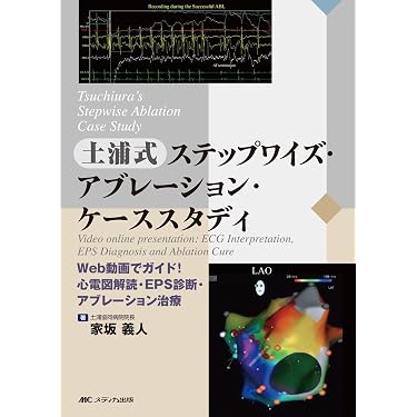 土浦式 ステップワイズ アブレーション ケーススタディ 心電図解読 EPS診断 Tsuchiura's Stepwise Ablation Case Study 土浦式ステップワイズ
